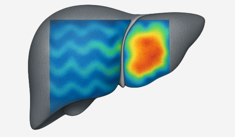Liver Elastography at Aashi Diagnostic Centre, Panvel, Navi Mumbai