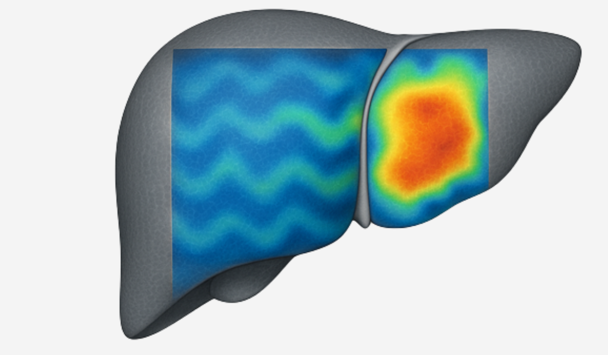 Liver Elastography at Aashi Diagnostic Centre, Panvel, Navi Mumbai